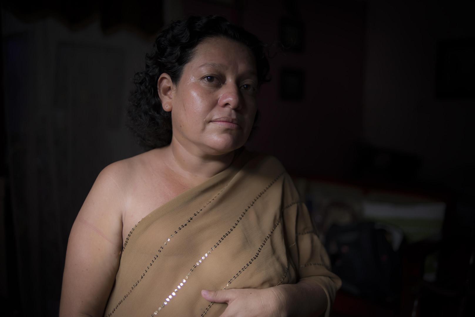 Managua, Nicaragua. 11/10/2021. Mujeres afectadas con cancer de mamás cuentan su lucha contra esta terrible enfermedad y su supervivencia para poder llevar sus vidas con sus familias. Oscar Navarrete/ Galeria News.